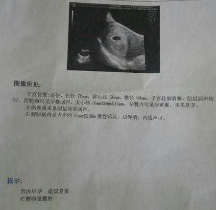 女人停经6年又出血了下腹痛,停经六天下腹部会有阵痛