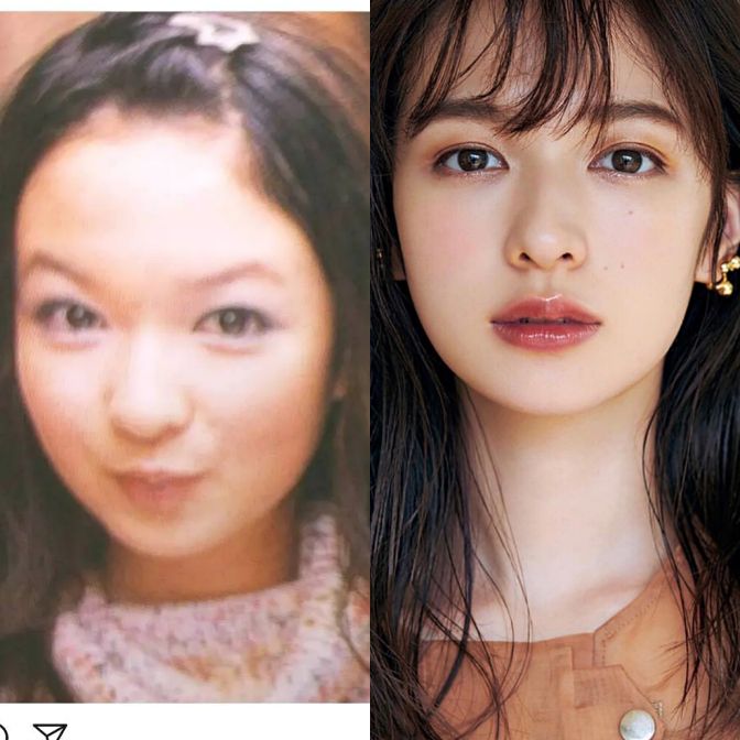 日本整容的鬼斧神工，来见识一下各位日星是整容了还是“长开”了