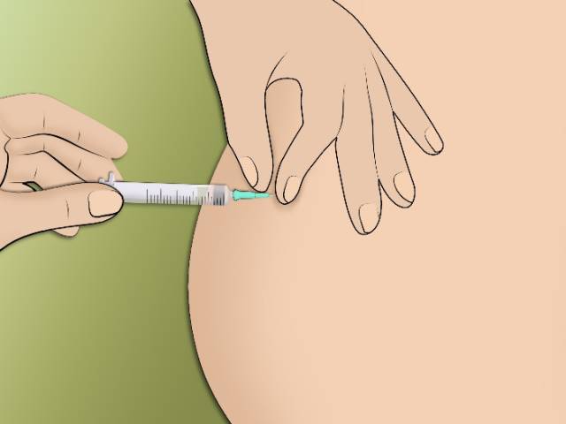 跑步时脚是外八字怎么纠正,膝盖内扣脚外八字跑步