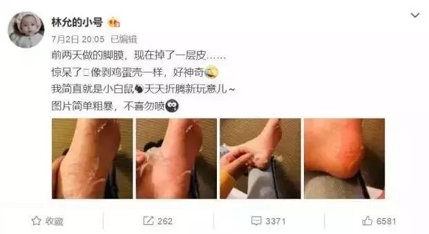 啊呀！你的脚后跟看起来糙得像位“真正男子汉”