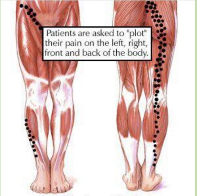 瑜伽侧压一字马,练瑜伽压青蛙趴的痛苦