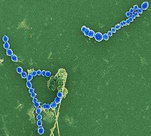 头疼全身酸痛发热是不是新冠肺炎,新冠肺炎发热是持续的还是反复的