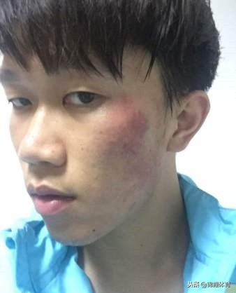 球场暴力事件完整版,球场暴力事件怎么处理