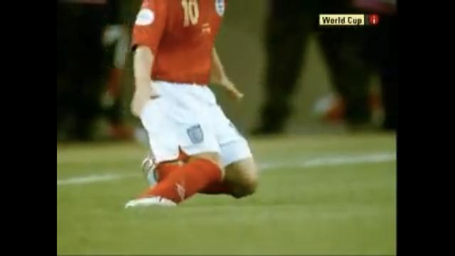 前交叉韧带断裂为什么没评上伤残,前交叉韧带断裂有什么症状