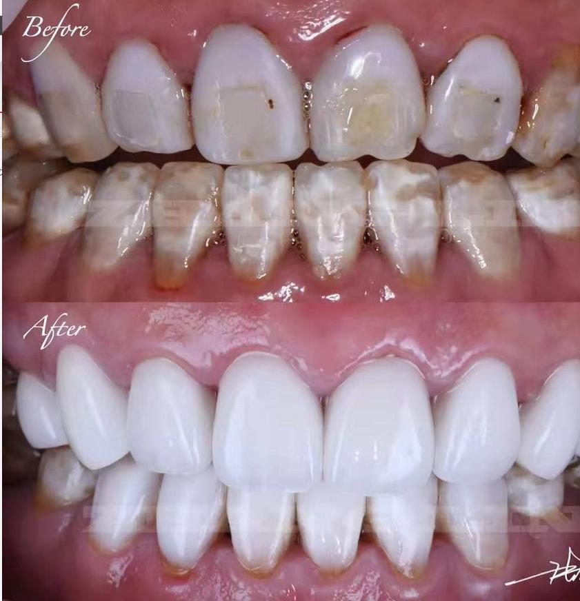 如何让牙齿变白最简单的方法,想要牙齿变白来试试这三种方法