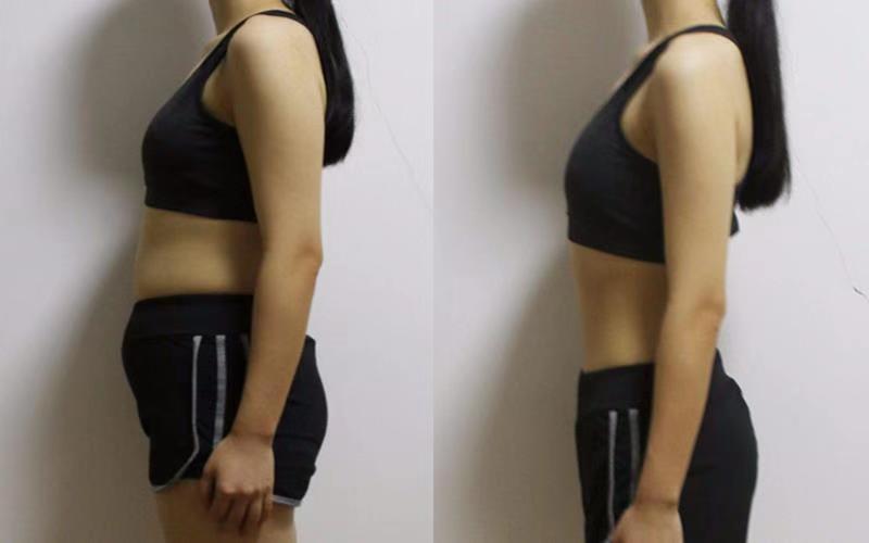 减肥导致大姨妈不来什么原因,减肥便秘不来大姨妈