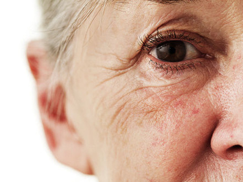 皮肤有痘印痘坑皱纹,脸上长痘痘画什么遮盖