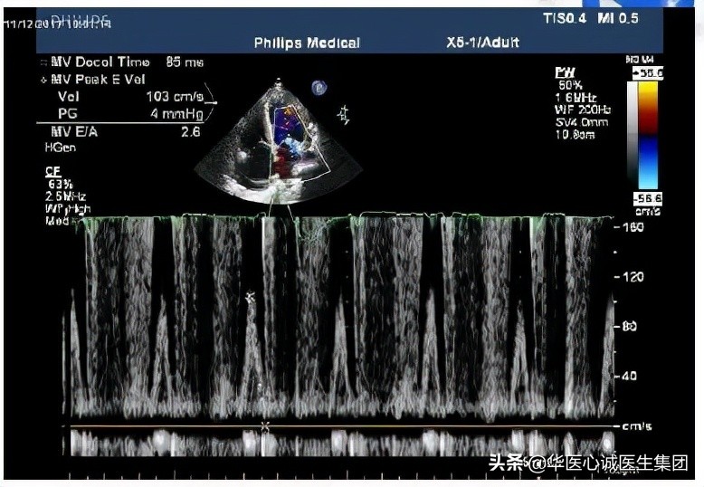 杨颖局部图,杨颖早期下颌宽大