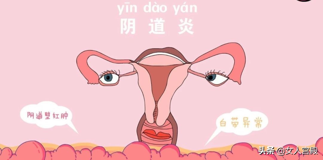 炎症——女性克星，你怕了吗？