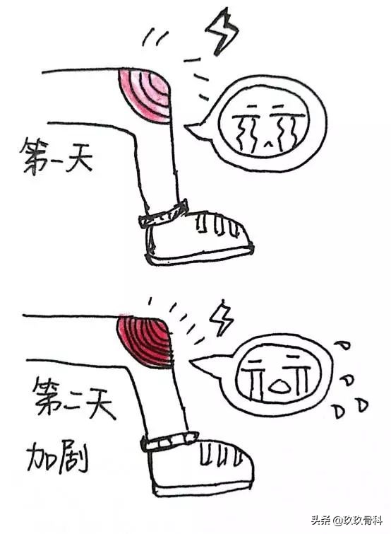 画说小哥哥膝盖疼是怎么回事？