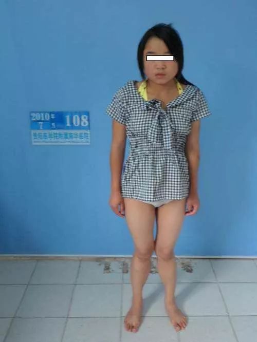 女的走路腿合不拢,为什么怀孕后腿合不拢了