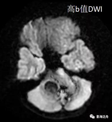 棰呰剳纾佸叡鎸痙wi搴忓垪,棰呰剳dwi搴忓垪鏈鏄庢樉寮傚父