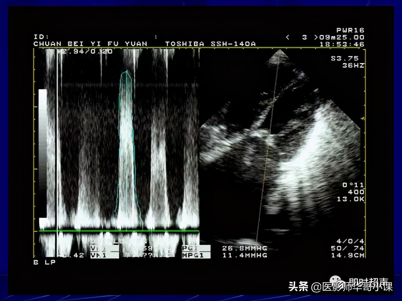 超声检查报告单讲解,超声图像检查