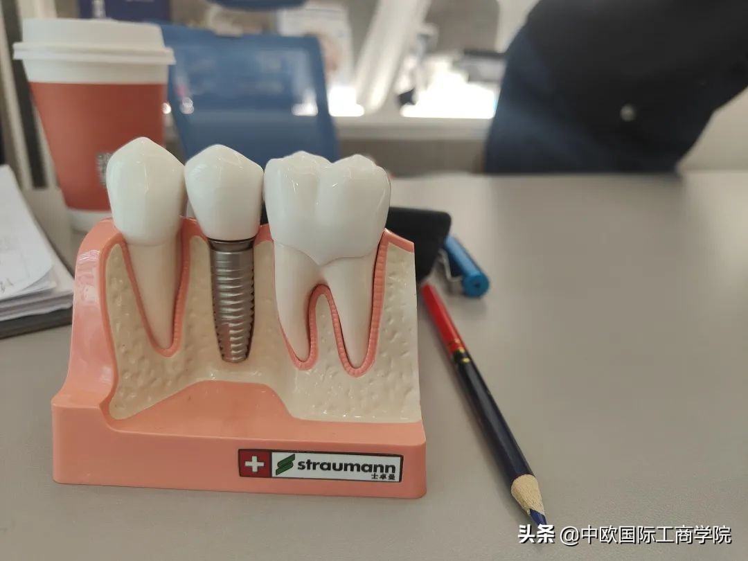 一口种植牙需要多少时间,一口牙种植牙