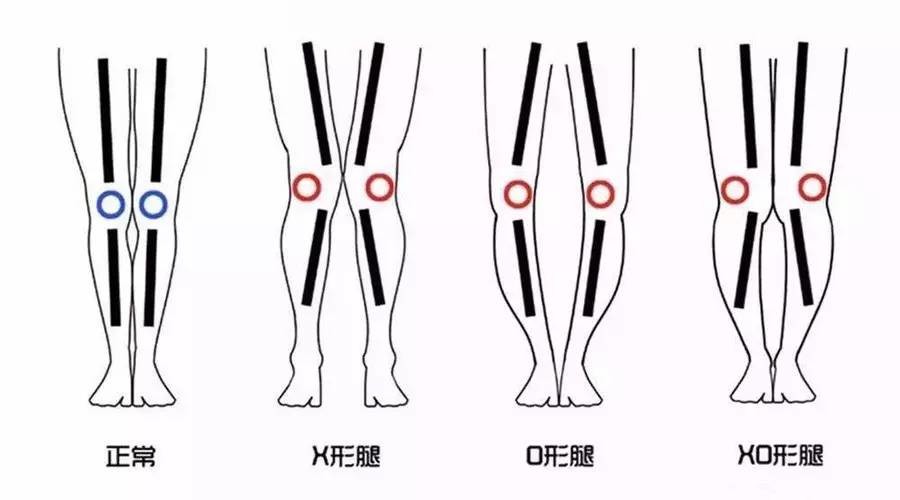 好久不活动一锻炼就膝盖疼,膝盖运动就疼休息就好