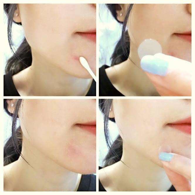 日本抗痘膏狮王,修丽可小绿瓶祛痘测评