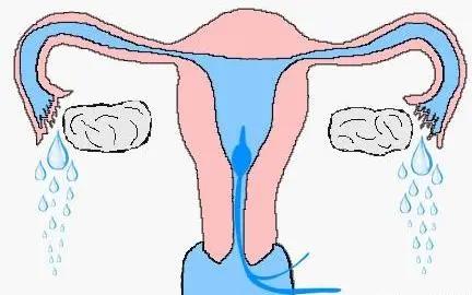 输卵管检查通液和造影的区别,检查输卵管是否通