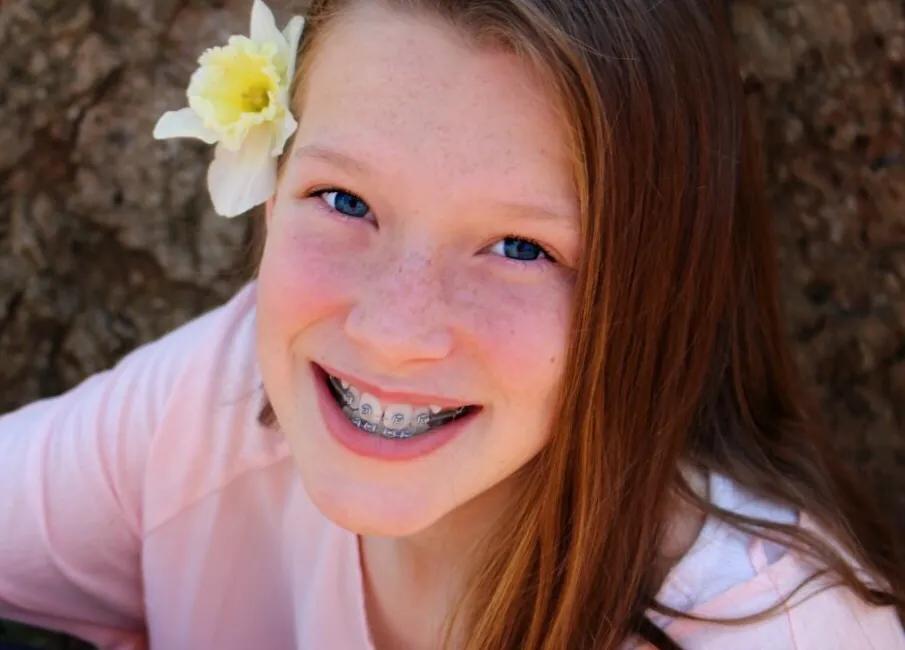 脸上有雀斑7秒钟搞定,雀斑一扫而光的原理