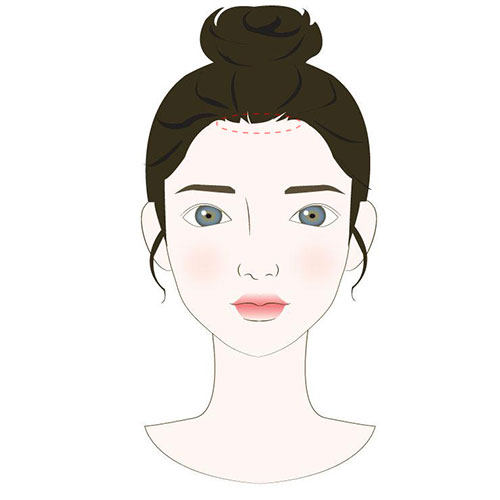 眉毛长痘的原因及解决方法,嘴边长痘是什么原因