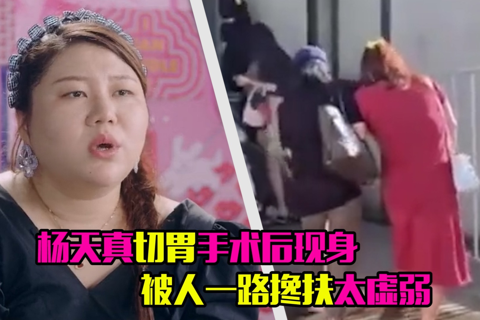 切掉一部分胃可以减肥吗,切掉半个胃能减多少斤