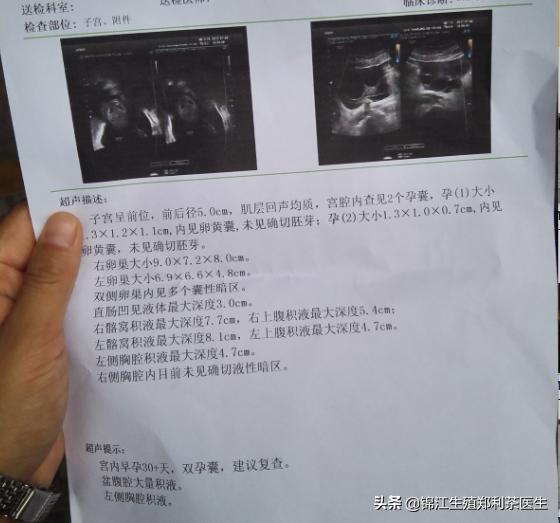 取完卵腹水了移植后还会腹水吗,取完卵后有腹水还能移植吗