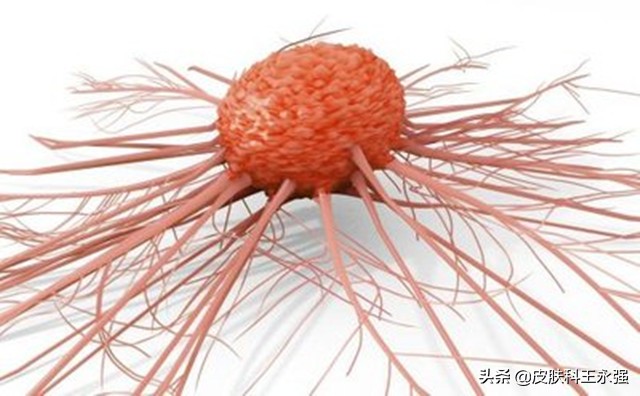 缠腰龙神经痛去医院挂什么科,缠腰龙疼得受不了怎么办