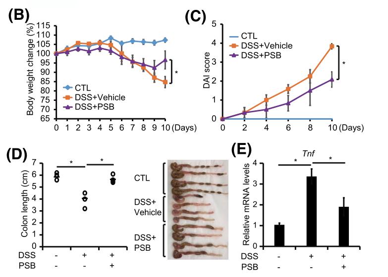 蓝莓干花青素可以减轻炎症反应,蓝莓便秘