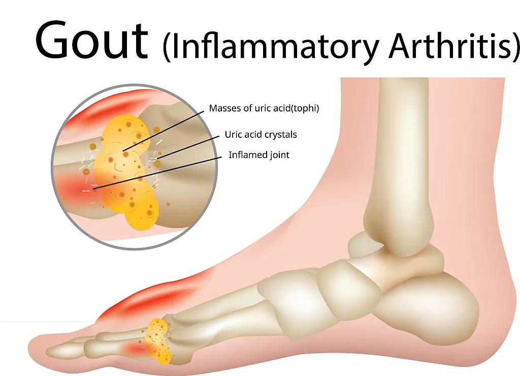 刷牙老是出血的中成药,健识药师真的有用吗