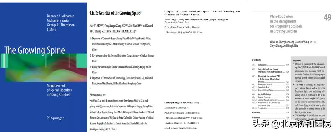 仉建国协和骨科专家,仉建国脊柱侧弯矫正