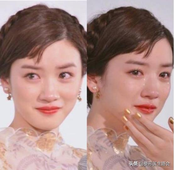 为什么长胖了鼻头也变大,鼻头大瘦下来会不会跟着变小