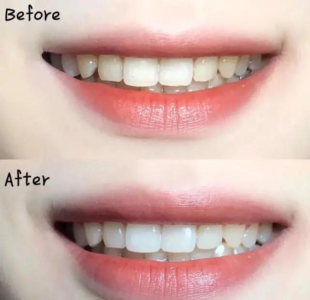 一张嘴就臭是咋回事,刷牙不管用的口臭怎么治