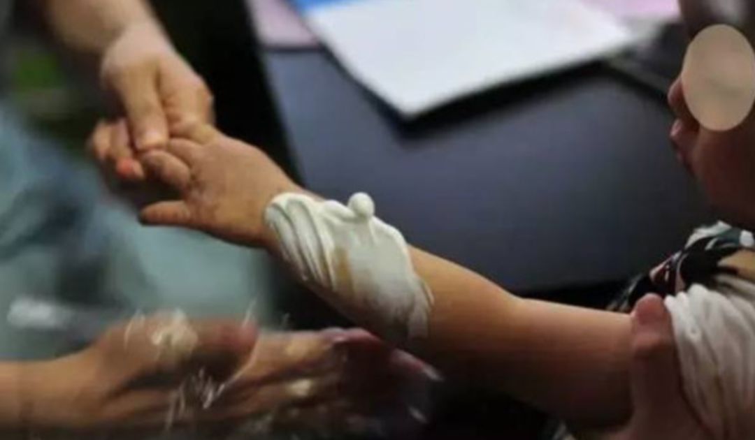 破皮结痂，又到湿疹高发季！这样护理更有效果