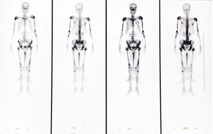 “显”为人知的核医学“神秘”——小“核”才露尖尖角