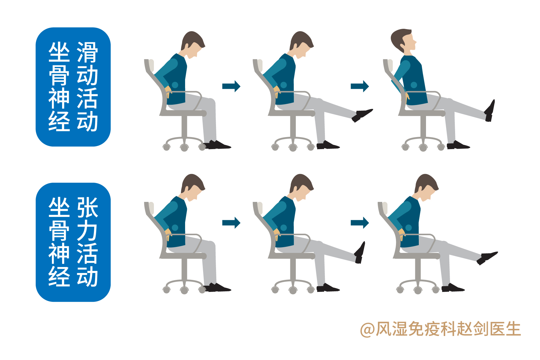 腰椎间盘突出要少运动?不宜跑步和健步走?医生:正确运动康复快