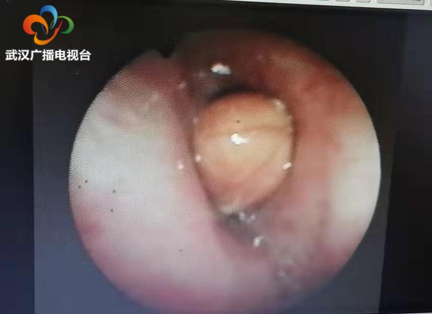 慢阻肺多年走几步就喘,慢阻肺老人深呼吸多长时间