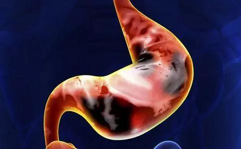 胃出血后吃什么有助于恢复,胃出血后调养期间食谱