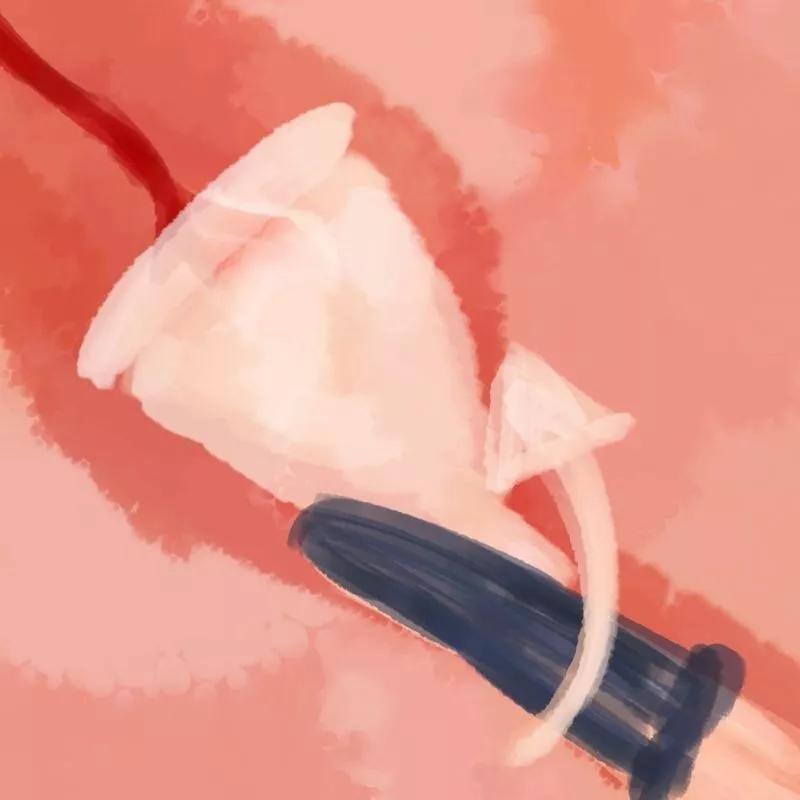 夜光杯和卫生巾哪个好,卫生巾和月亮杯利弊