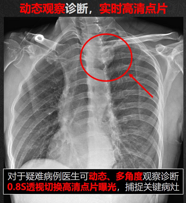 专访ChinaMed上的安健科技——“动态DR不是我们的终点！”