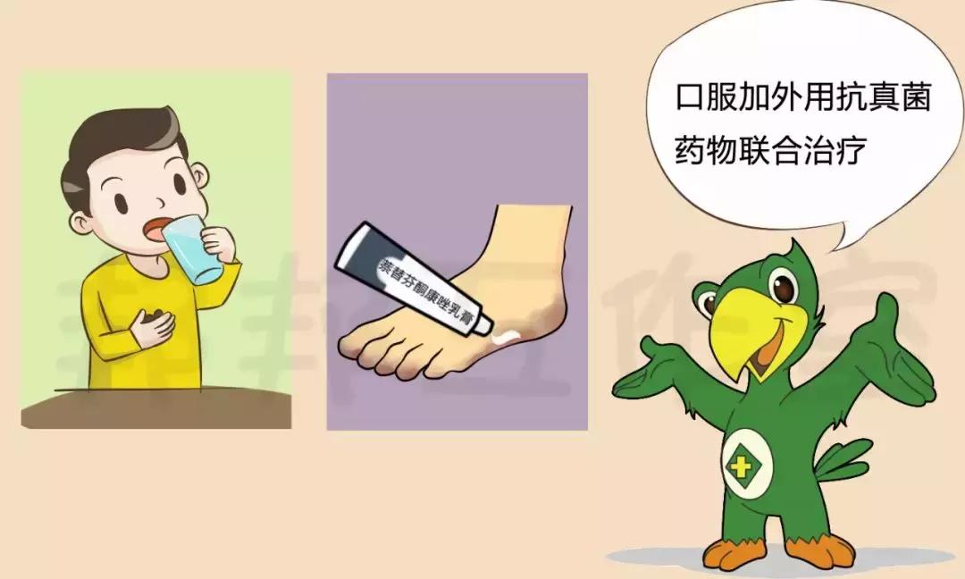 脚气能治好吗可以彻底治愈吗,脚气脚臭怎么治才能彻底根除