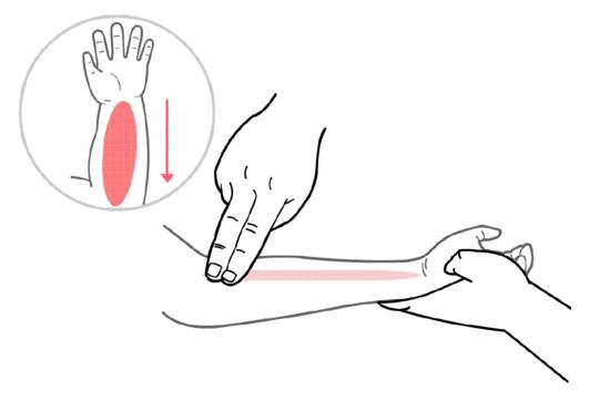 小儿咳嗽雾化用药配方,咳嗽有痰雾化好还是推拿好