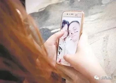 与狗狗玩耍时不小心被狗狗刮伤,养狗不拴绳一家三口遭恶犬咬伤