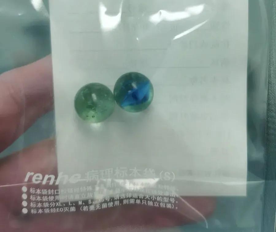 四岁小男孩往小丁丁里塞弹珠？那些年孩子塞进去的东西远不止这个