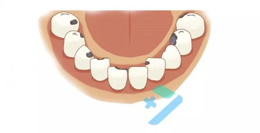 牙齿有虫洞要花多少钱,牙齿上的小黑洞是个烧钱的无底洞