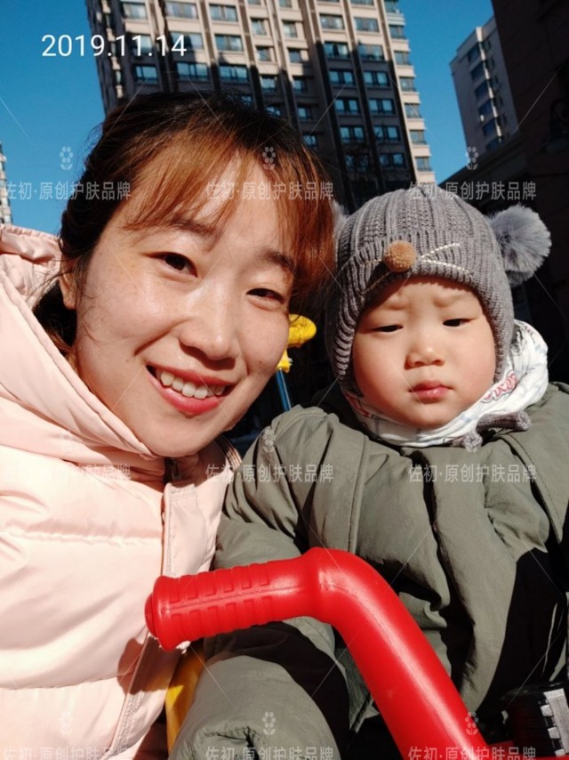 生完孩子烂脸,生完孩子脸上垮了怎样处理