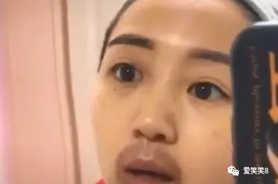 谁说在嘴上拔罐可以治牙疼,拔罐妹子治牙疼