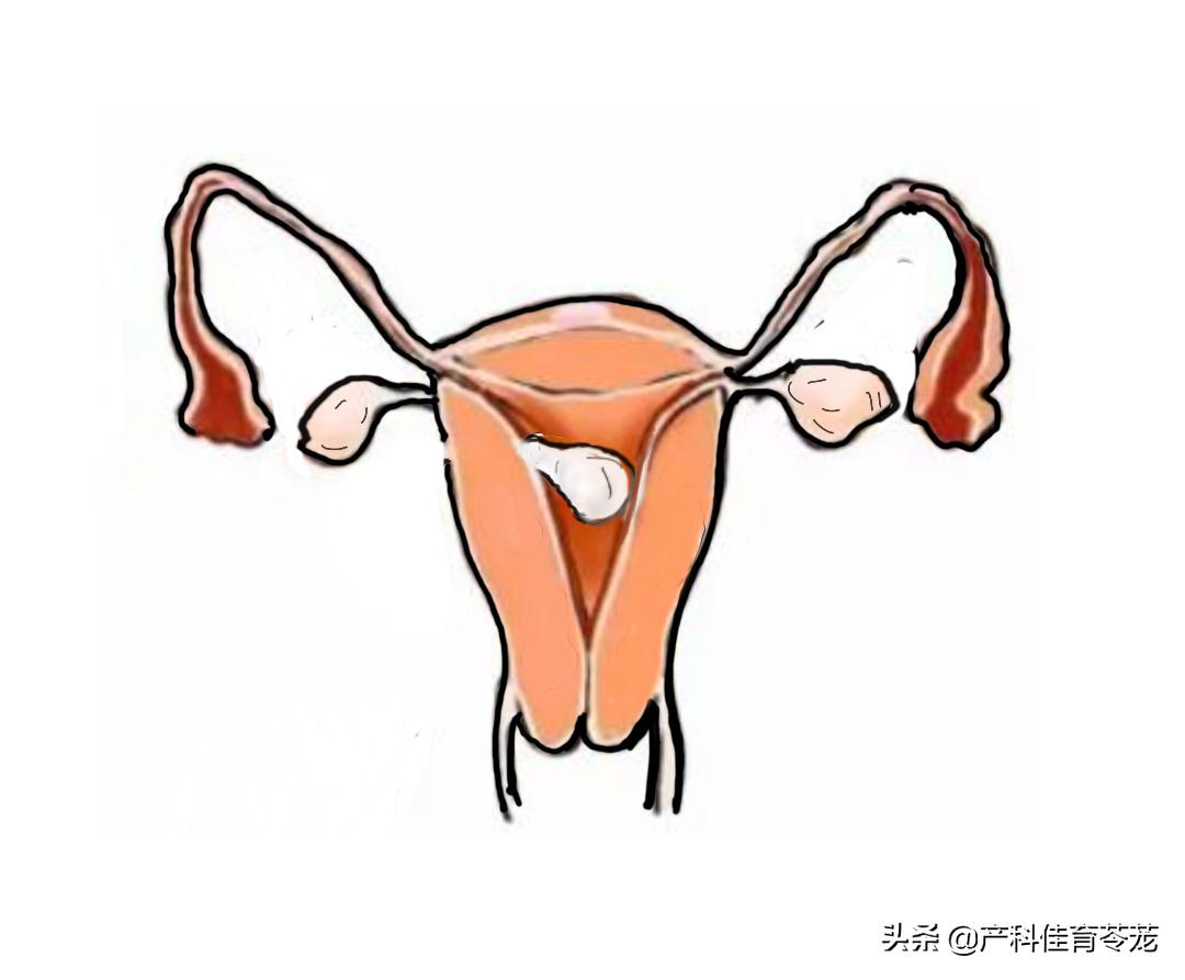 月经不调延后如何调理月经量少,月经不调不正常量少