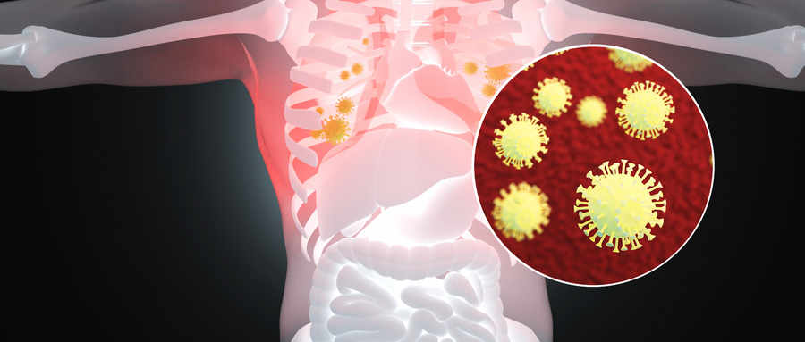 肿瘤细胞多大时会发生转移,肿瘤转移的过程和机制