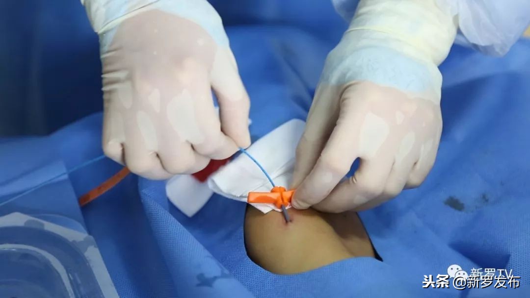 应急静脉通道工程师——龙岩人民医院静脉输液治疗专科（PICC）小组侧记