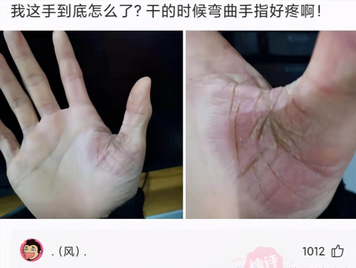 神回复：我有被虐倾向怎么办？能治好吗？网友：我命令你命令我