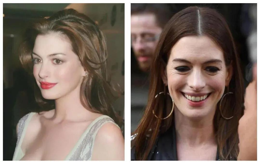 真牛！松弛老态的眼周，都被“马应龙”治住了